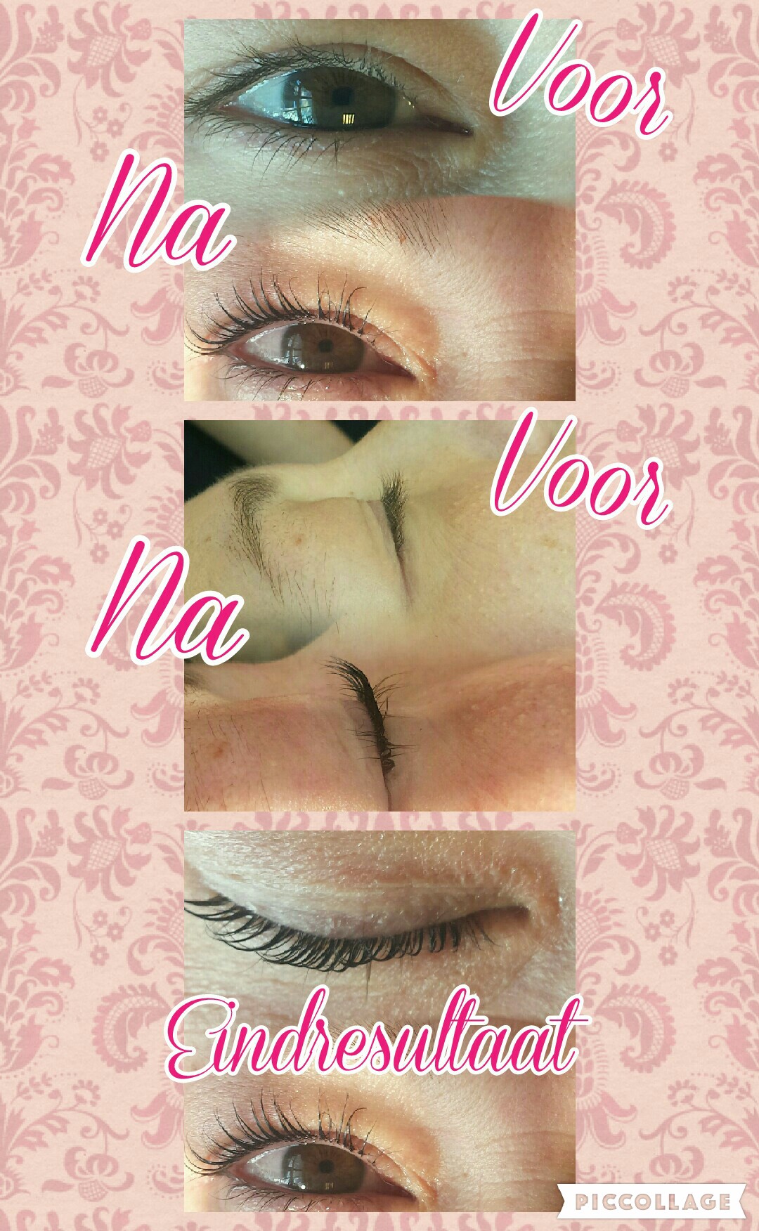 Wimperlifting
