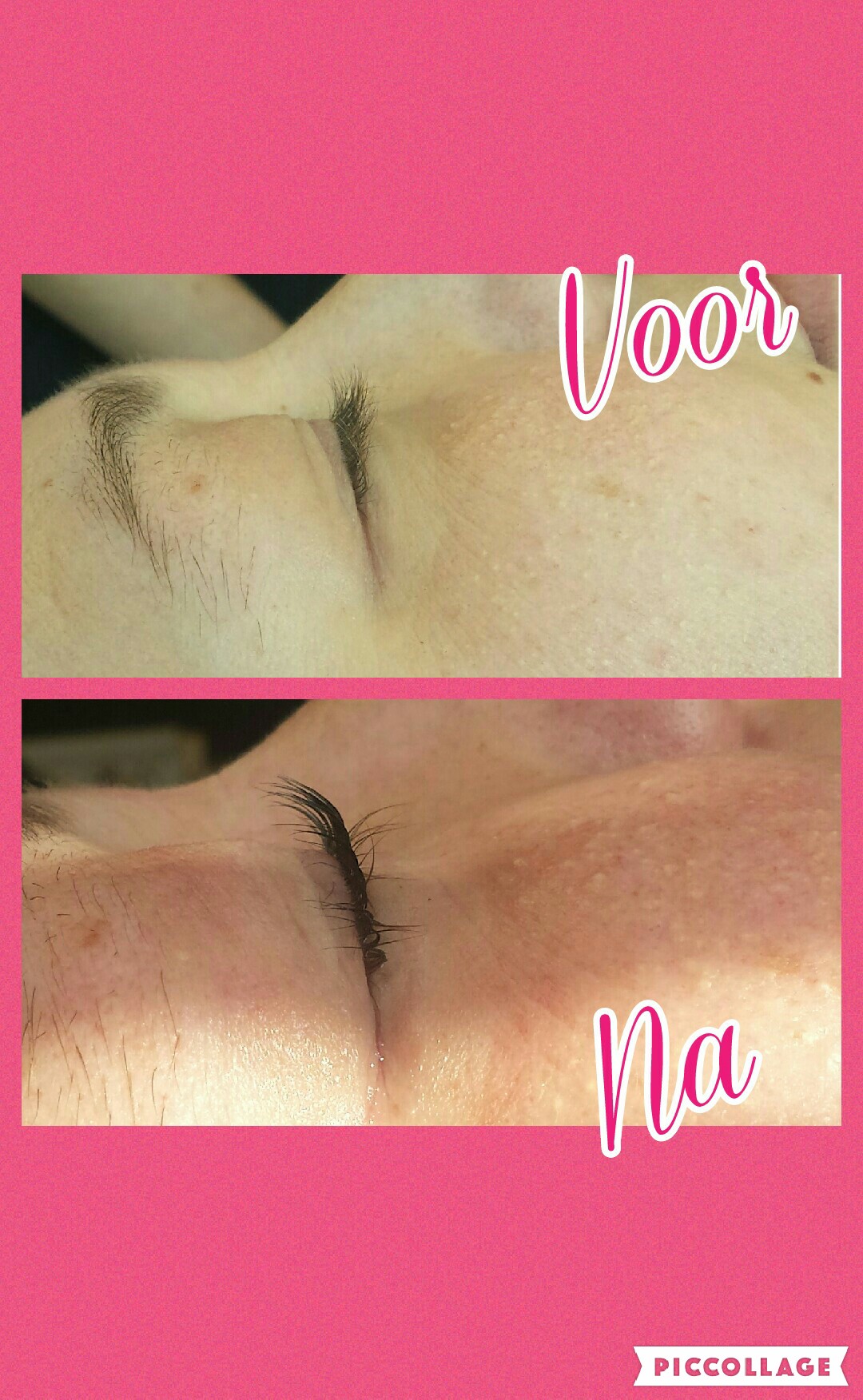 Wimperlifting