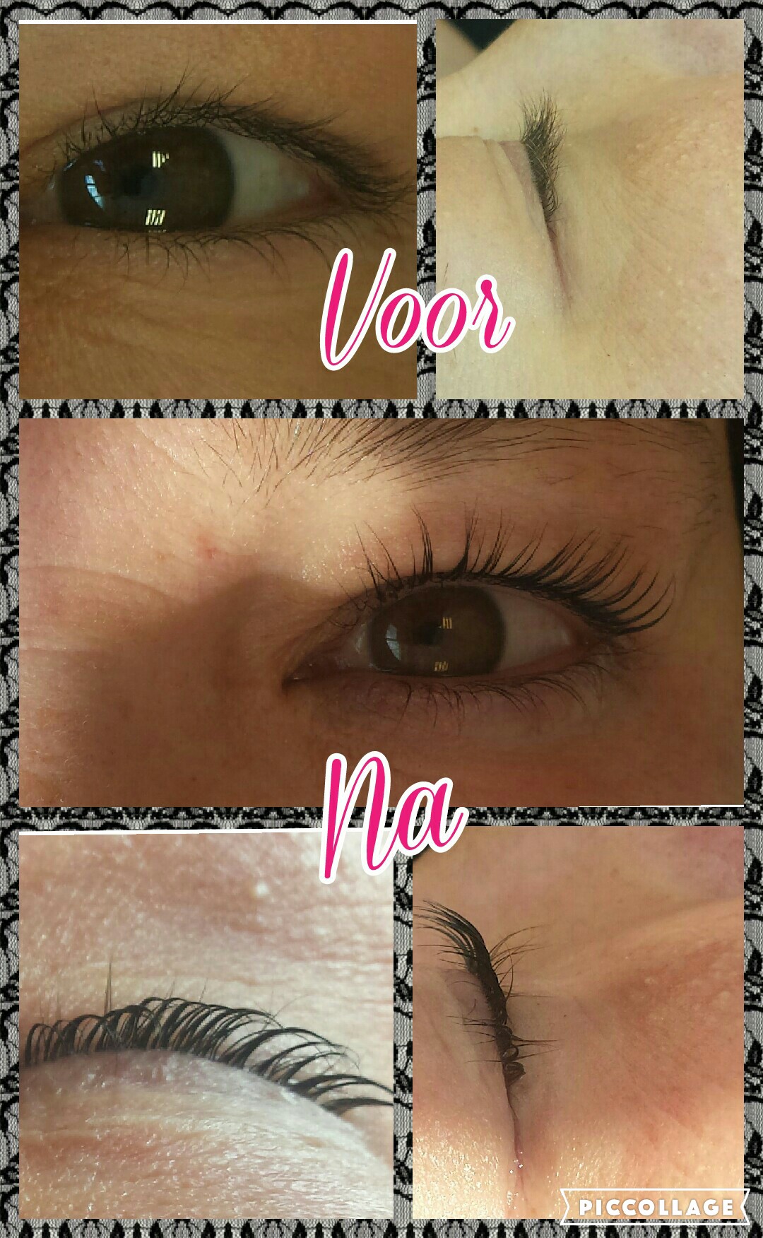 Wimperlifting