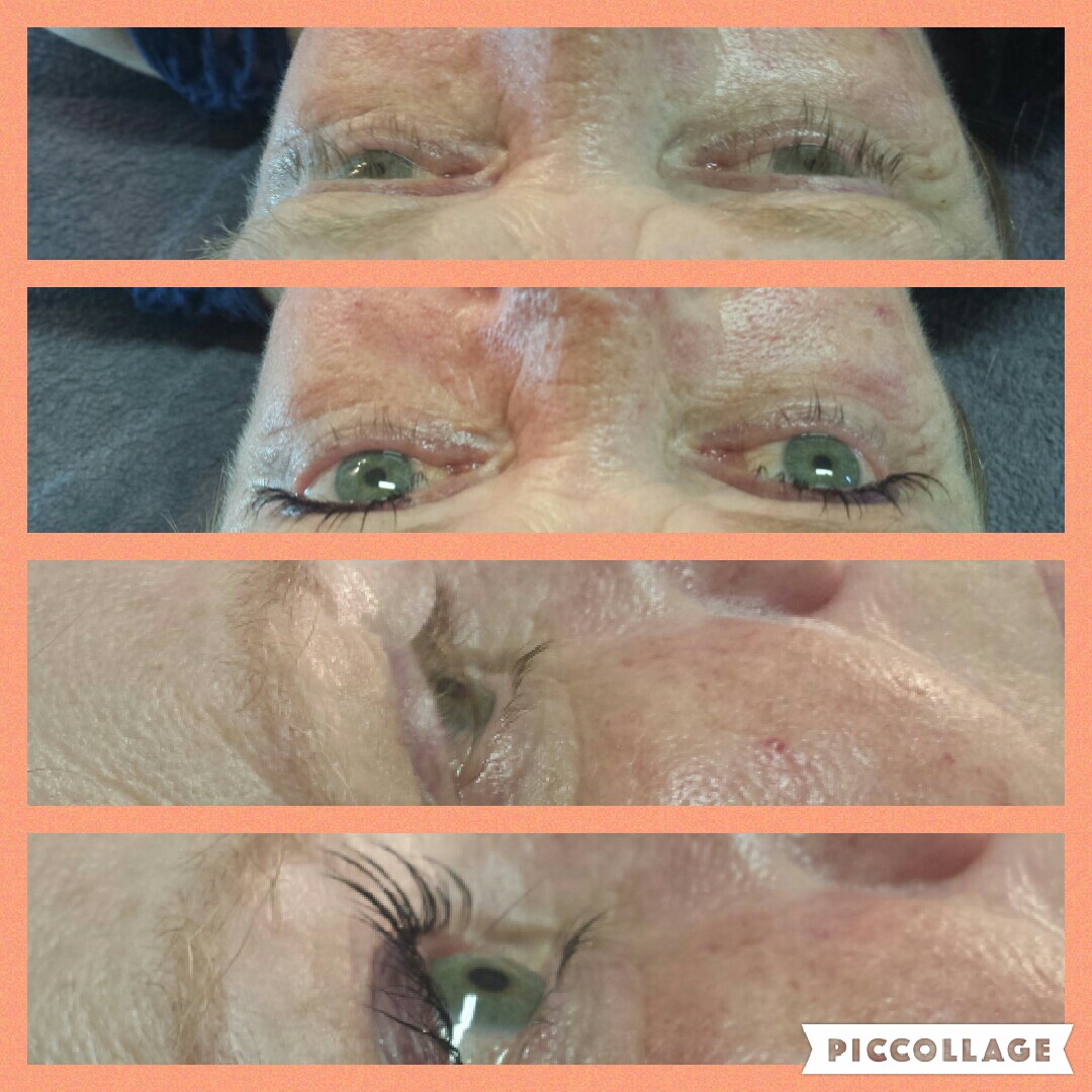 Wimperlifting