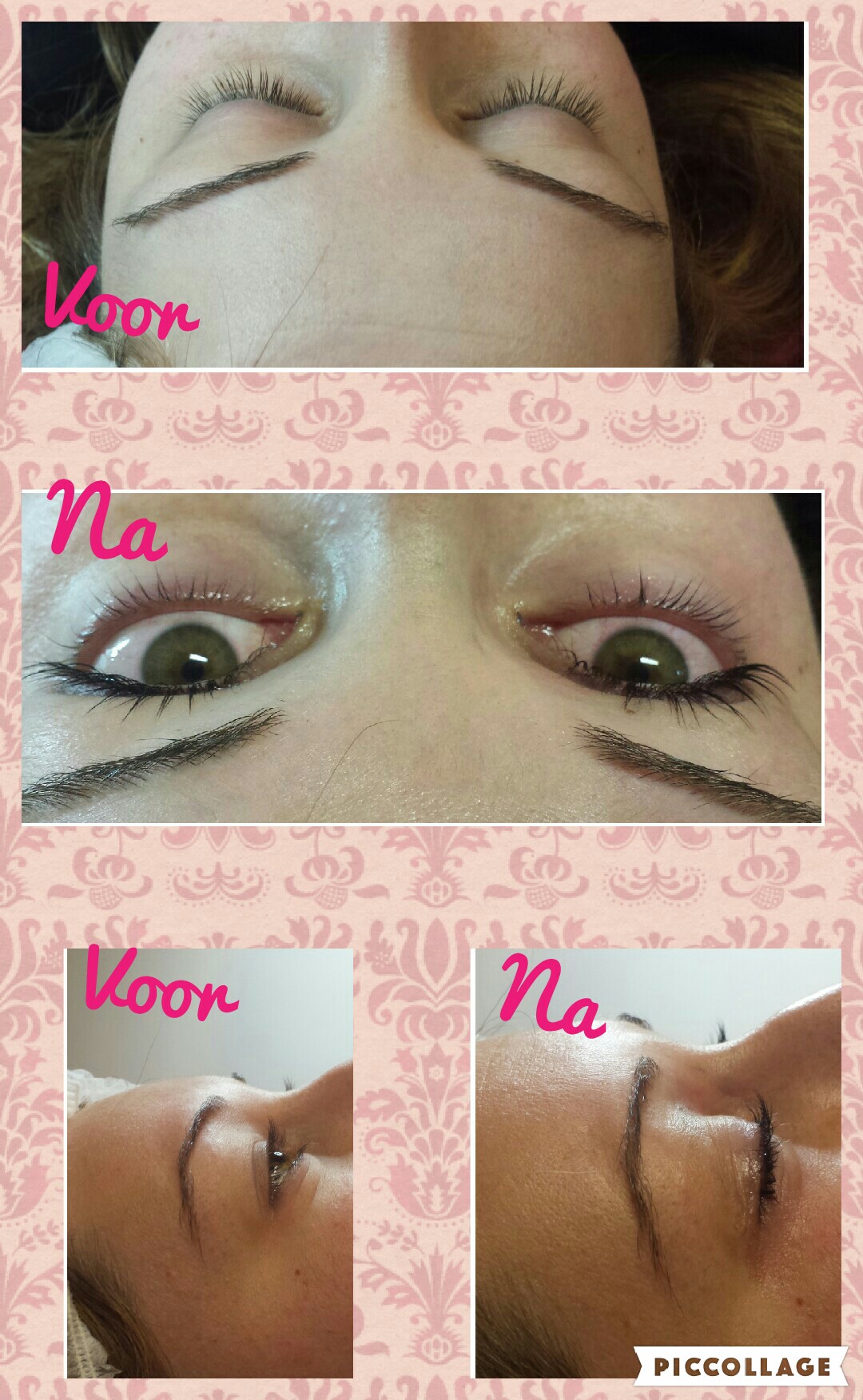 Wimperlifting